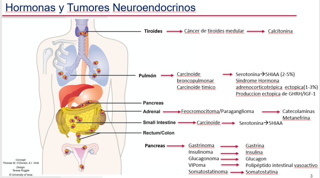 Día Contra El Cáncer Neuroendocrino Qué Es Y Cuáles Son Sus Síntomas Primera Edición 