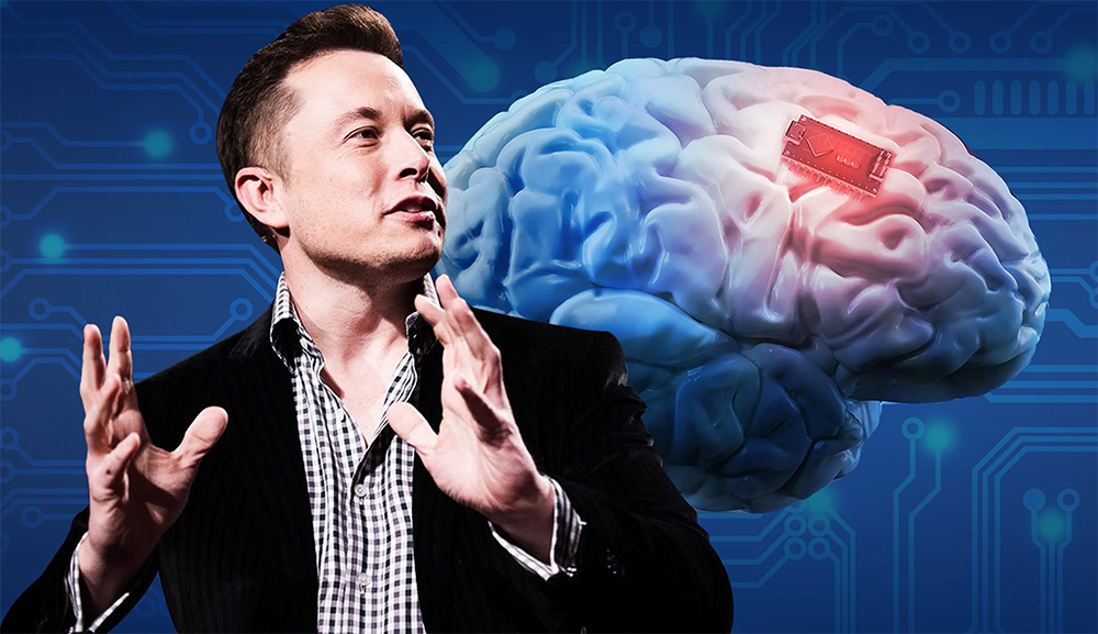 Histórico Neuralink Empresa De Elon Musk Implanta El Primer Chip Cerebral En Un Ser Humano